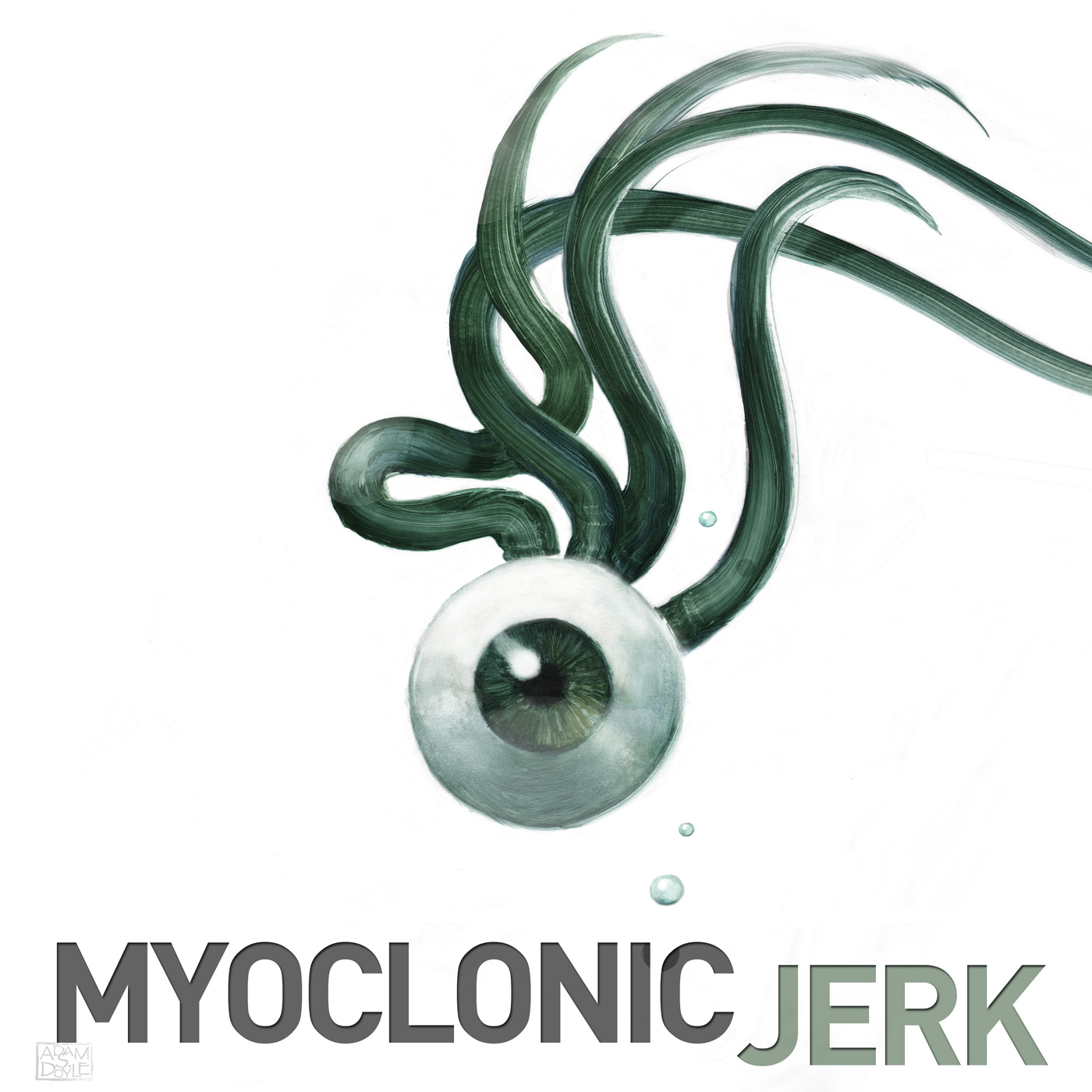 Myoclonic Jerk